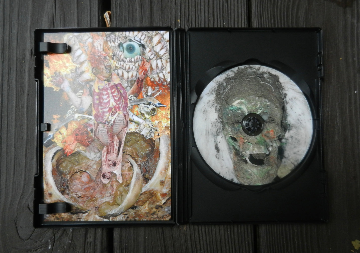 Corpse Syndrome DVD