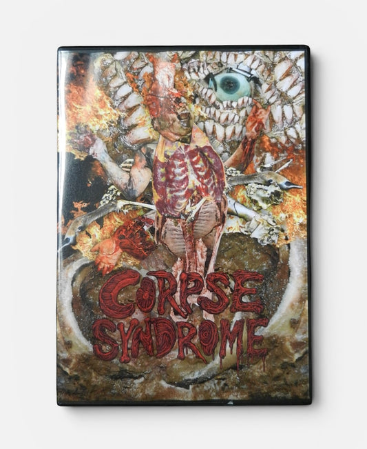 Corpse Syndrome DVD