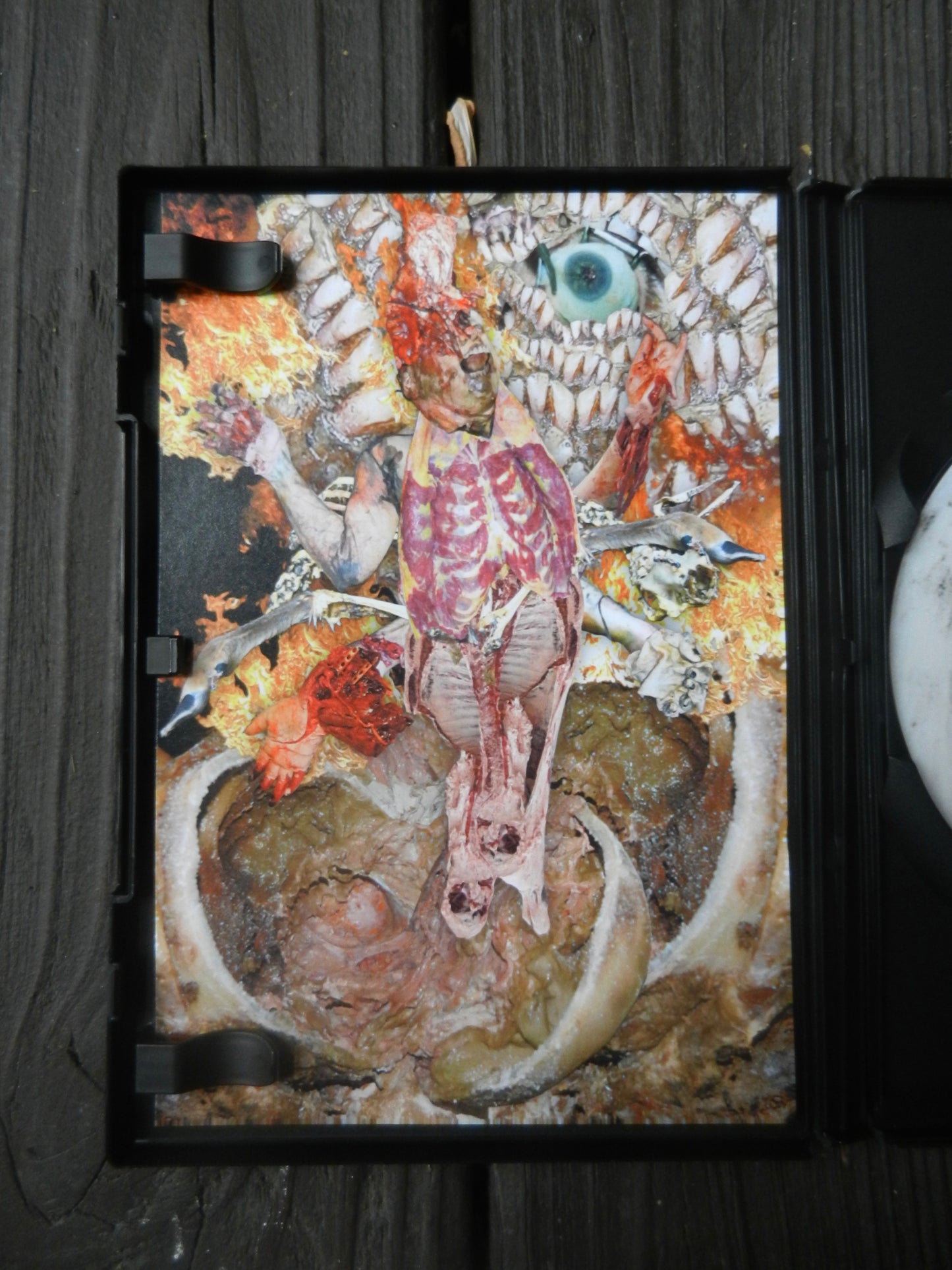 Corpse Syndrome DVD
